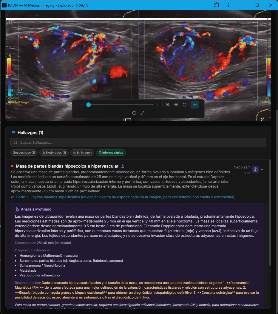 Deep Analysis of soft tissue mass in RADIA: dimensions 25x40mm, clinical differential (hemangioma, sarcoma, schwannoma, metastasis), recommendation for MRI and biopsy
