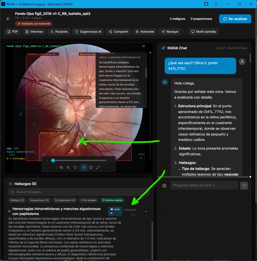 RADIA PointAsk: user clicks on point (34%, 77%) of fundus photograph, Chat AI panel responds with structured analysis of intraretinal hemorrhages and cotton wool spots in the indicated area